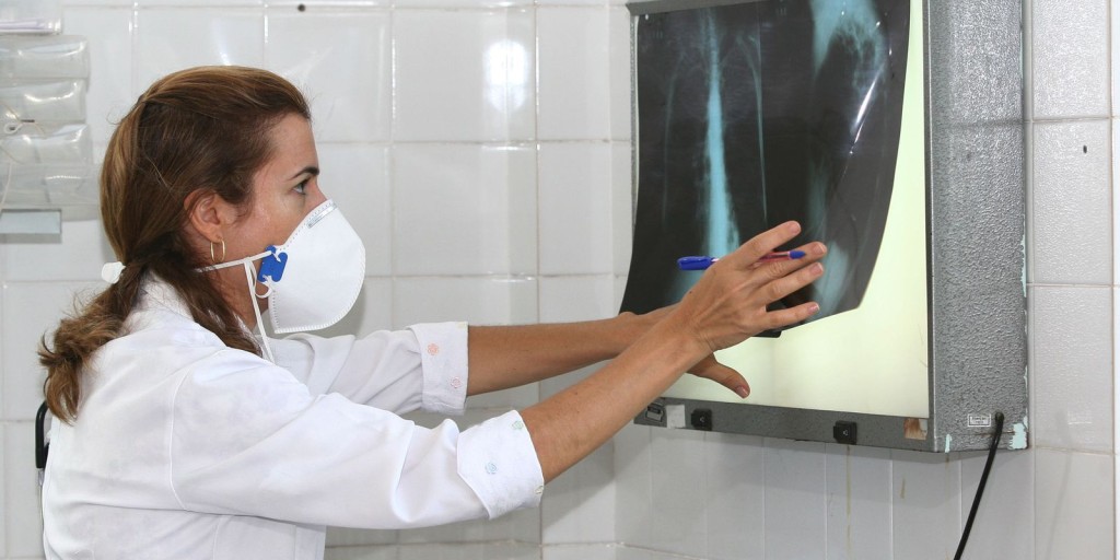 Governo cria comitê para reduzir casos de tuberculose até 2030