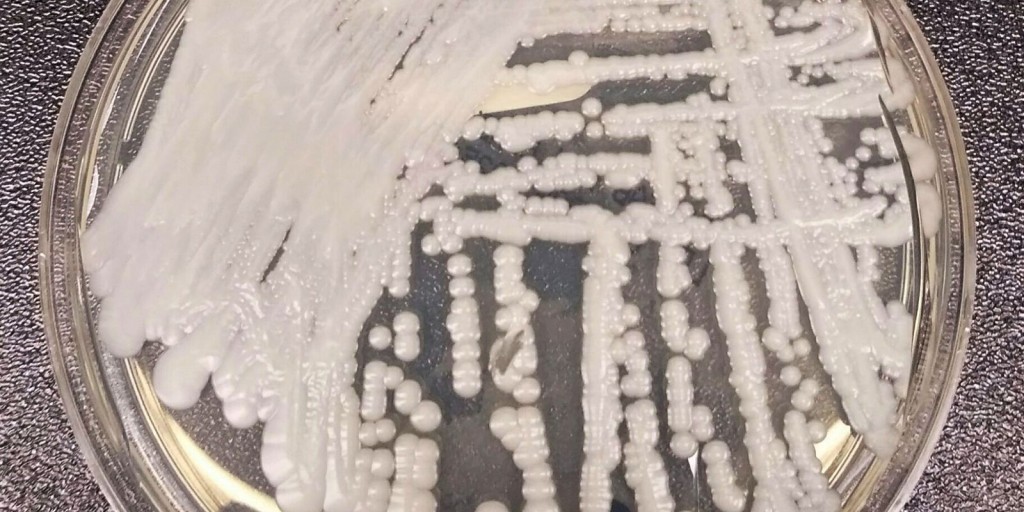 São Paulo confirma primeiro caso de superfungo Candida auris