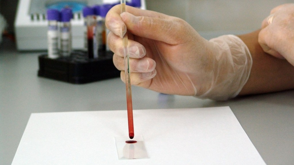 Febre maculosa: Anvisa autoriza novo produto para diagnóstico